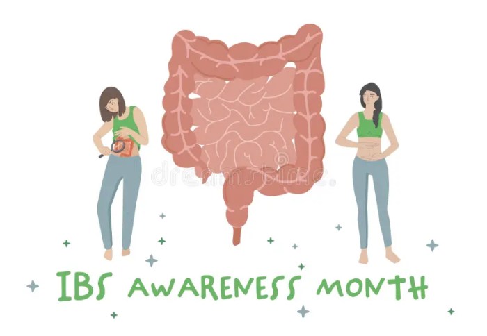 Bowel syndrome irritable wiley internal medicine journal implications dietary